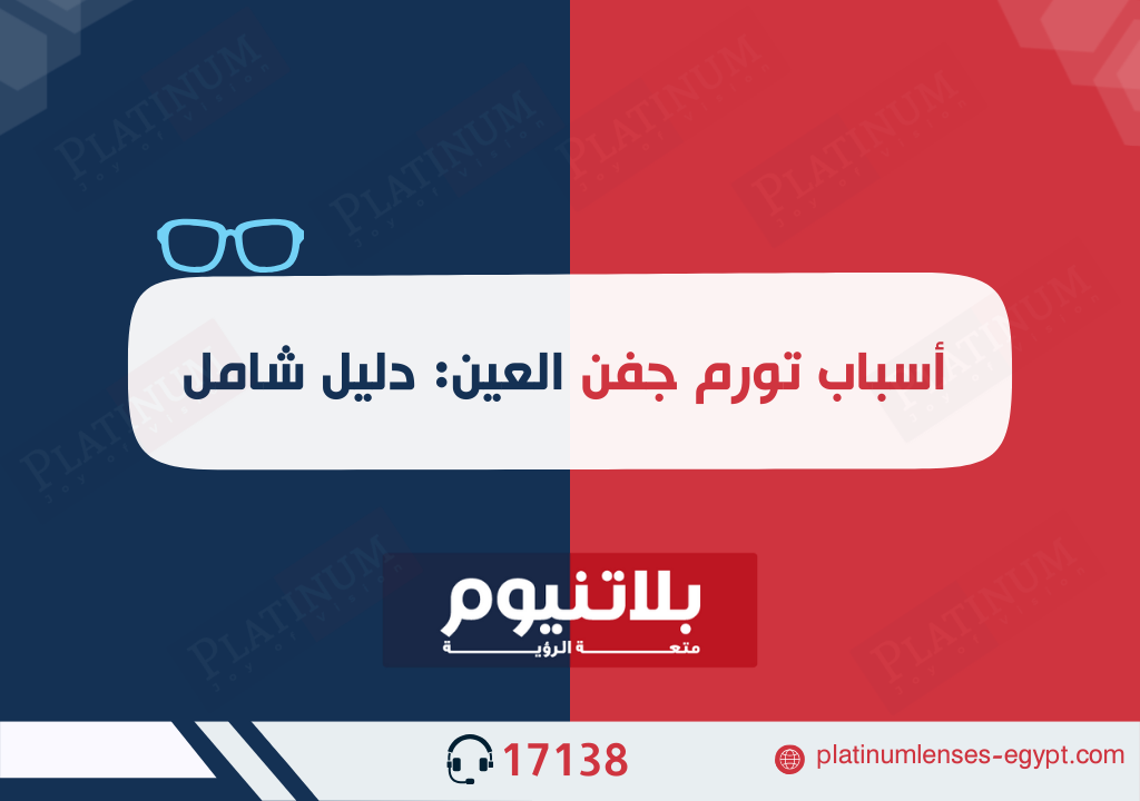 أسباب تورم جفن العين: دليل شامل