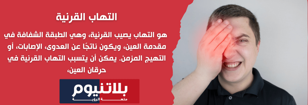 التهاب القرنية والتشخيص المبكر لحرقان العين