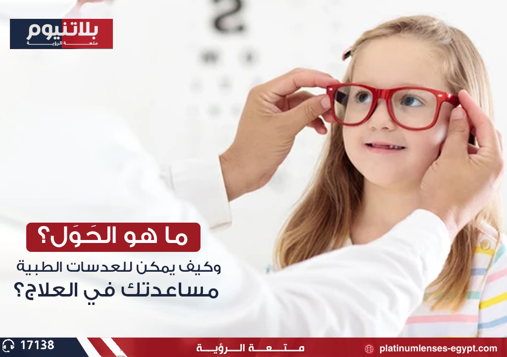 ما هو الحَوَل وكيف يمكن للعدسات الطبية مساعدتك في العلاج؟