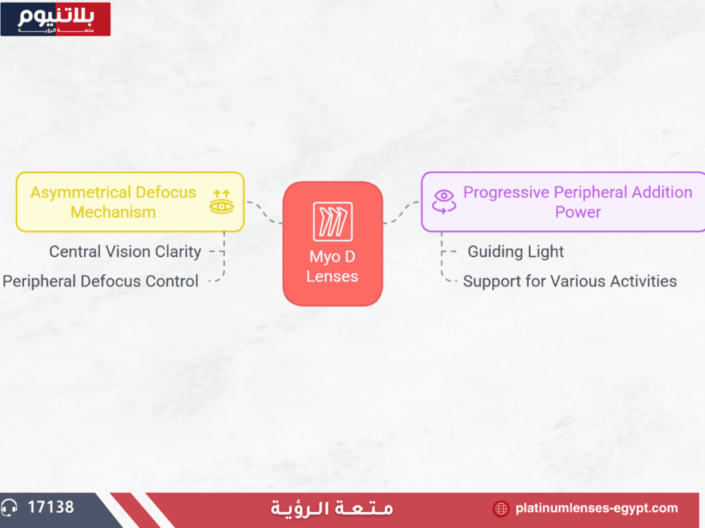 الأساس العلمي وراء تصميم عدسات Myo D لإدارة قصر النظر