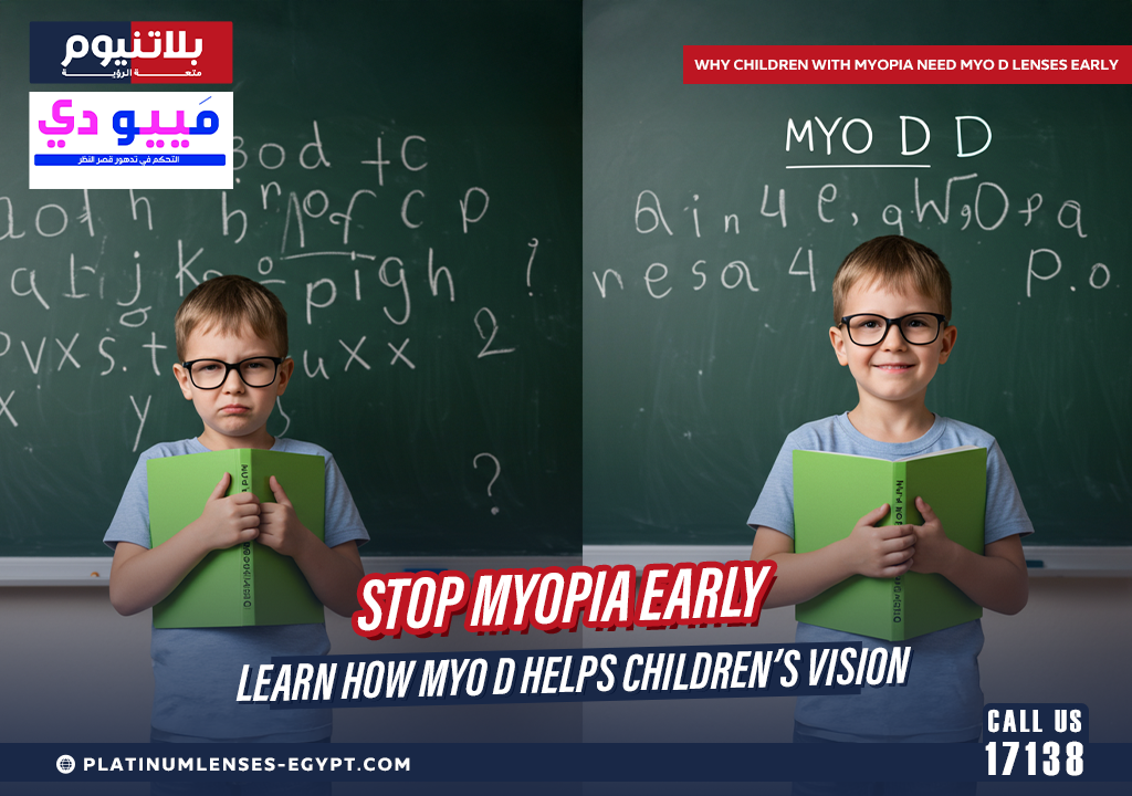 Why Children with Myopia Need MYO D Lenses Early