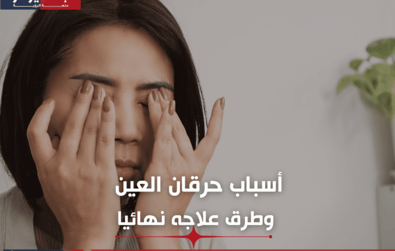 أسباب حرقان العين وطرق علاجه نهائيا