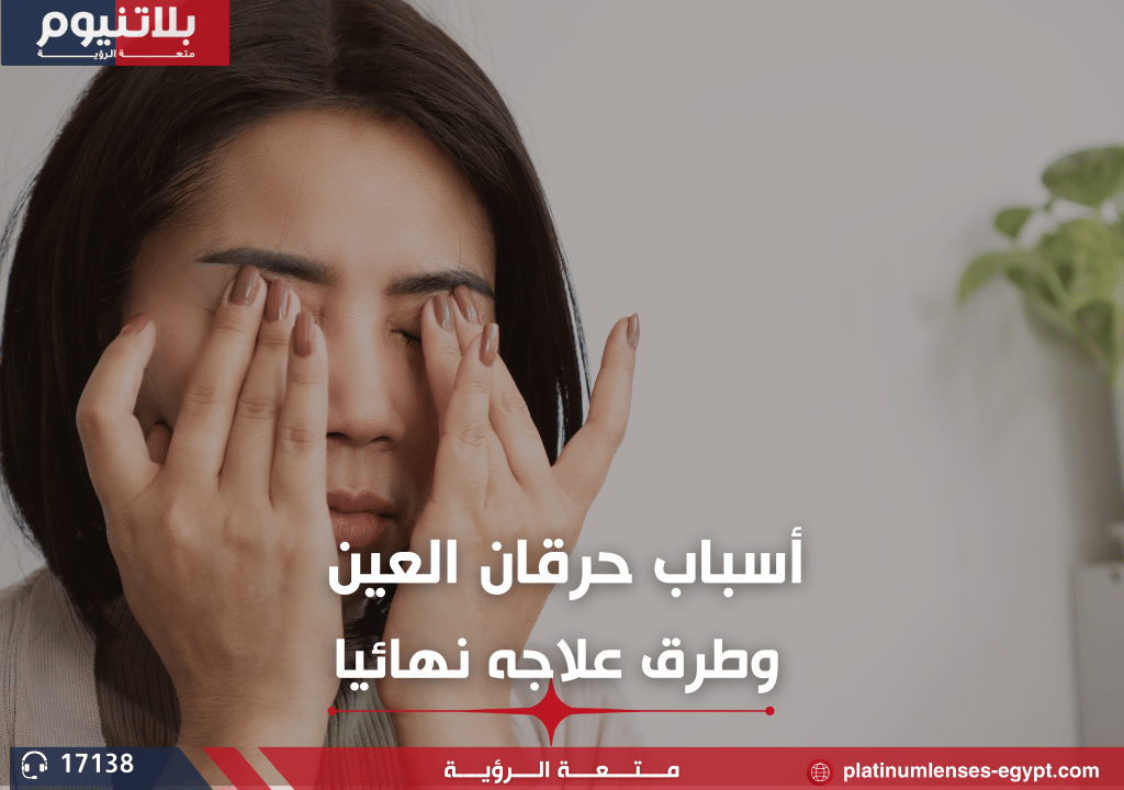 أسباب حرقان العين وطرق علاجه نهائيا