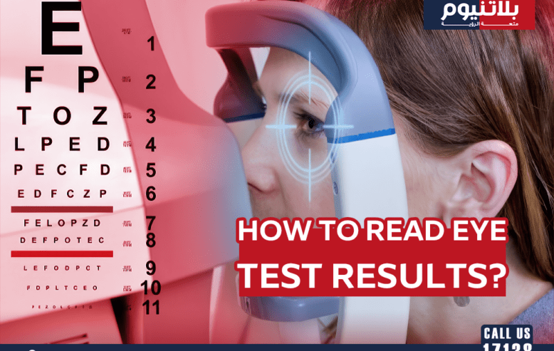 How to Read Eye Test Results?