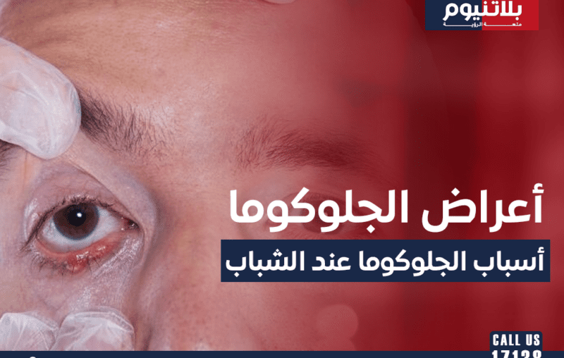 أعراض الجلوكوما وما هي أسباب الجلوكوما عند الشباب