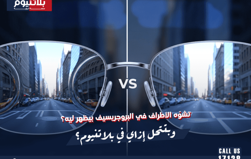 تشوّه الأطراف في البروجريسيف بيظهر ليه؟ وبتتحل إزاي في بلاتنيوم؟