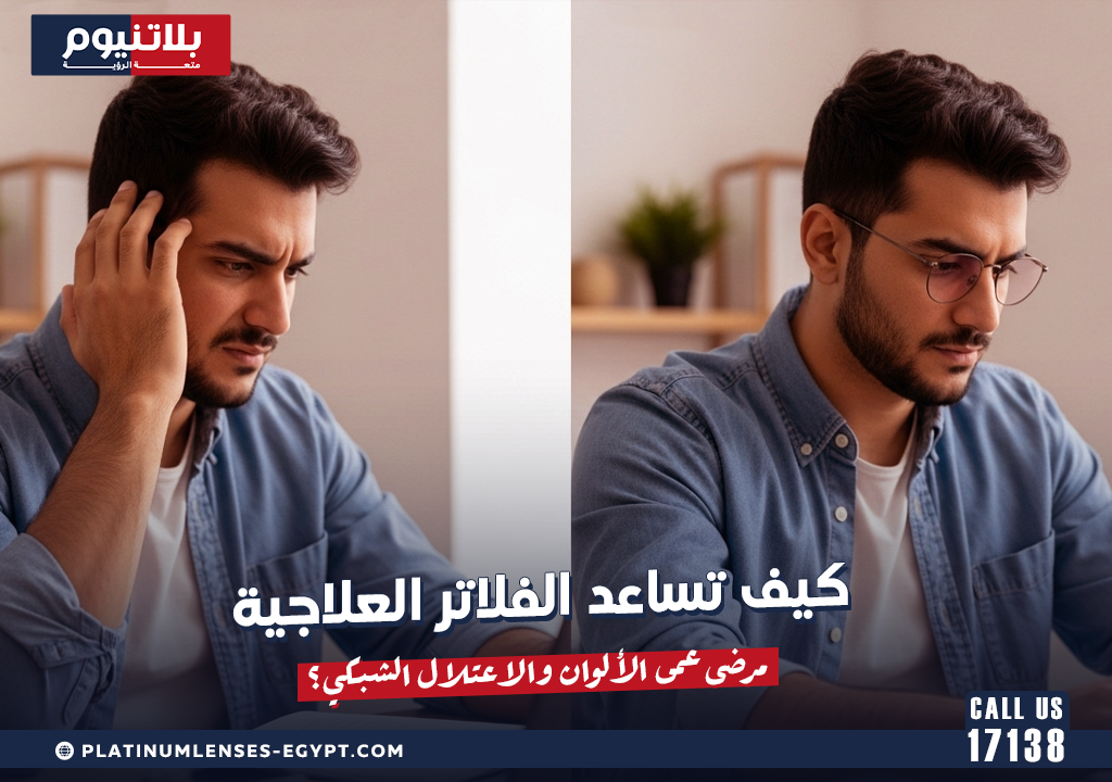 كيف تساعد الفلاتر العلاجية مرضى عمى الألوان والاعتلال الشبكي؟