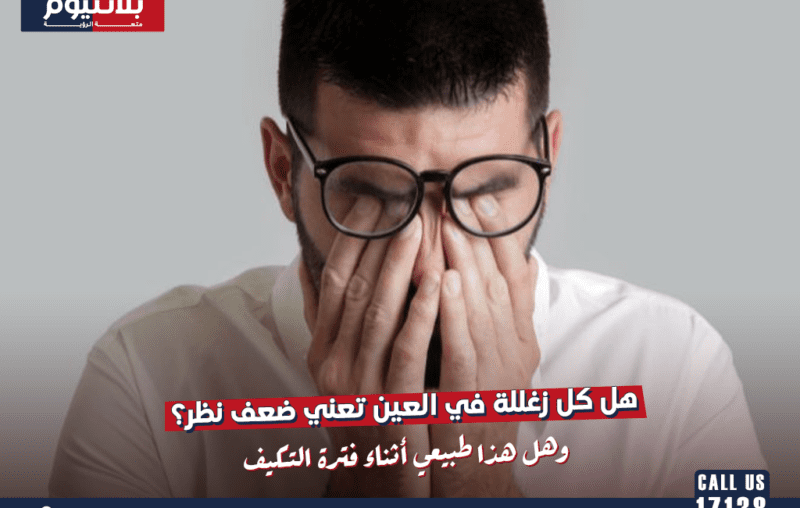 هل كل زغللة في العين تعني ضعف نظر؟ حالات مؤقتة تختفي بتعديل العادات اليومية فقط