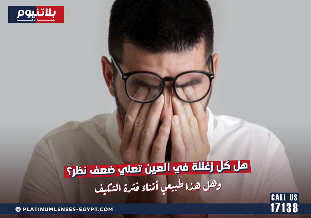 هل كل زغللة في العين تعني ضعف نظر؟ حالات مؤقتة تختفي بتعديل العادات اليومية فقط