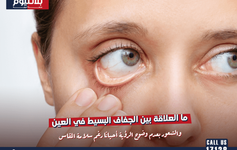ما العلاقة بين الجفاف البسيط في العين والشعور بعدم وضوح الرؤية أحيانًا رغم سلامة المقاس