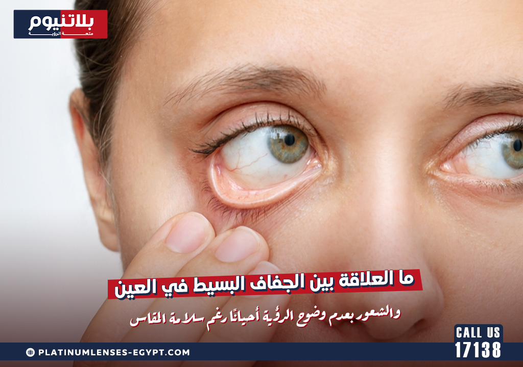 ما العلاقة بين الجفاف البسيط في العين والشعور بعدم وضوح الرؤية أحيانًا رغم سلامة المقاس