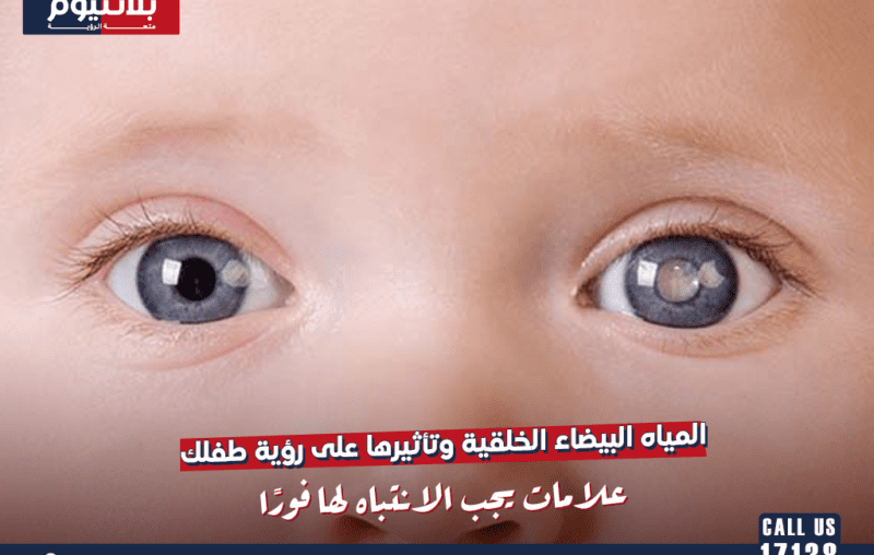 المياه البيضاء الخلقية وتأثيرها على رؤية طفلك: علامات يجب الانتباه لها فورًا