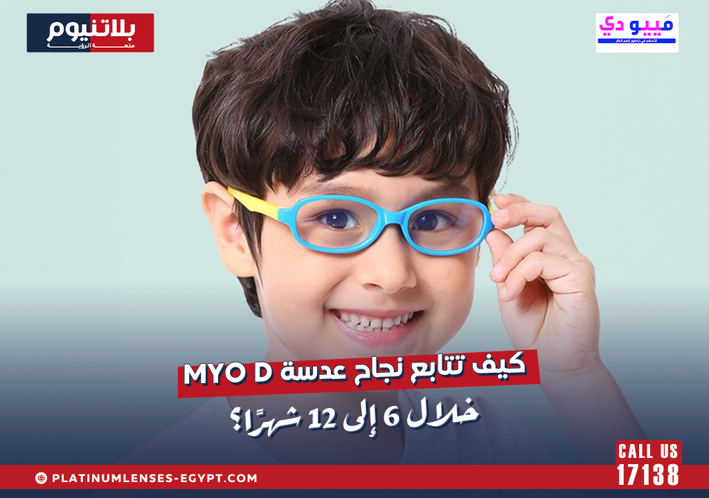 كيف تتابع نجاح عدسة Myo D خلال 6 إلى 12 شهرًا؟
